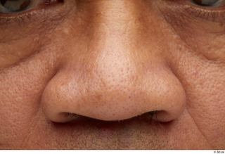 HD Face Skin Jacoby Dillard cheek face nose skin pores…